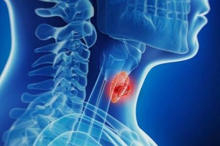 افزایش آمار تشخیص بدخیمی‌های تیروئیدی