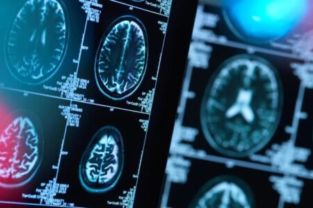 هشدار به بیماران صرعی و آسمی درباره قطع دارو در ایام روزه‌داری