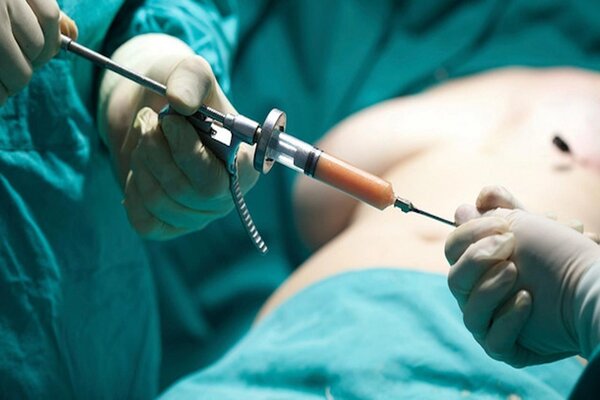 ۸۲ درصد تهرانی‌های بالای ۳۰ سال دچار اضافه وزن یا چاقی هستند