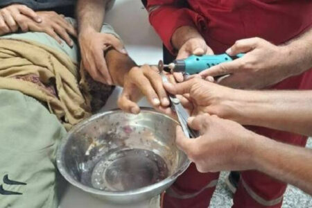 رهاسازی انگشتر از دست مصدوم در بیمارستان جاسک